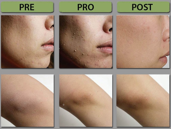 O.R.G Skincare Mineral Peel Face 59ml